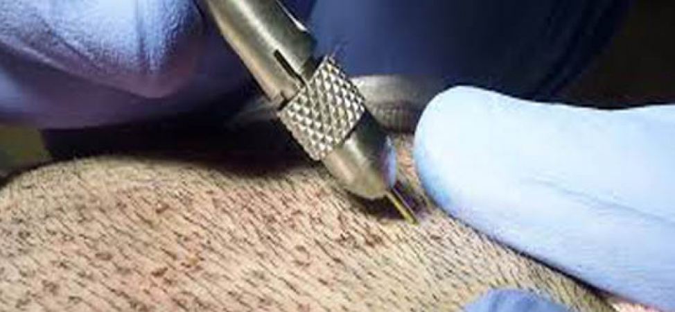 “²ثورة” يابانية في زراعة الشعر